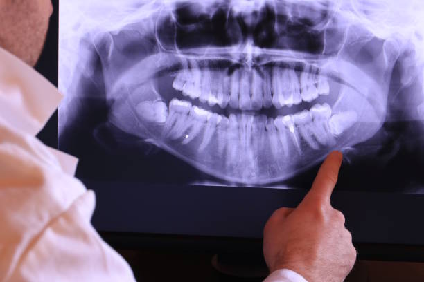 Best Emergency Root Canal Treatment in Thunder Mountain, NM