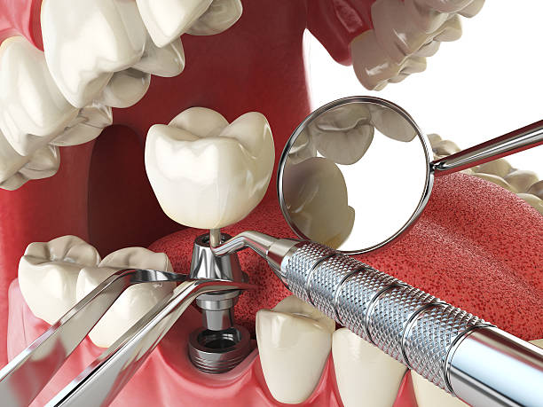 Best Broken or Cracked Tooth Emergency Dentist in Thunder Mountain, NM